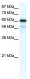 Gamma-Aminobutyric Acid Type A Receptor Alpha1 Subunit antibody, TA338499, Origene, Western Blot image 