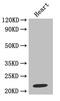 TIMP Metallopeptidase Inhibitor 1 antibody, abx210198, Abbexa, Western Blot image 