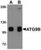 Autophagy Related 9B antibody, PA5-20998, Invitrogen Antibodies, Western Blot image 
