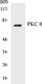Protein Kinase C Theta antibody, EKC1467, Boster Biological Technology, Western Blot image 
