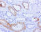 Alpha-Methylacyl-CoA Racemase antibody, LS-C799241, Lifespan Biosciences, Immunohistochemistry paraffin image 