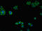 CD25 antibody, CSB-PA011649LA01HU, Cusabio, Immunofluorescence image 