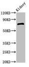 Zinc Finger And BTB Domain Containing 16 antibody, LS-C680061, Lifespan Biosciences, Western Blot image 