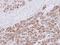 Proteasome Subunit Alpha 3 antibody, GTX113529, GeneTex, Immunohistochemistry paraffin image 