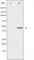 Mitogen-Activated Protein Kinase Kinase 2 antibody, abx011136, Abbexa, Western Blot image 
