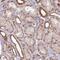 General Transcription Factor IIH Subunit 3 antibody, PA5-52122, Invitrogen Antibodies, Immunohistochemistry paraffin image 