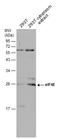 Eukaryotic Translation Initiation Factor 4E antibody, GTX132092, GeneTex, Western Blot image 