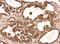 Nuclear FMR1 Interacting Protein 1 antibody, NBP2-19607, Novus Biologicals, Immunohistochemistry paraffin image 