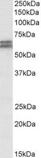 Interferon Alpha And Beta Receptor Subunit 1 antibody, 43-296, ProSci, Western Blot image 