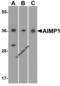 Aminoacyl TRNA Synthetase Complex Interacting Multifunctional Protein 1 antibody, 7513, ProSci, Western Blot image 