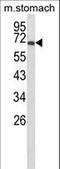 GLIS Family Zinc Finger 1 antibody, LS-C166503, Lifespan Biosciences, Western Blot image 