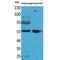 Aldehyde Dehydrogenase 1 Family Member A1 antibody, LS-C386922, Lifespan Biosciences, Western Blot image 