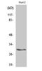 Tyrosine 3-Monooxygenase/Tryptophan 5-Monooxygenase Activation Protein Beta antibody, STJ91367, St John