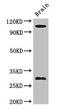 EPH Receptor A1 antibody, CSB-PA007720LA01HU, Cusabio, Western Blot image 