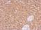 Lactoylglutathione lyase antibody, GTX628890, GeneTex, Immunohistochemistry paraffin image 