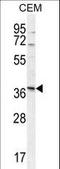 Neurexophilin 4 antibody, LS-C163089, Lifespan Biosciences, Western Blot image 