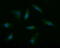 Musashi RNA Binding Protein 2 antibody, M02898-1, Boster Biological Technology, Immunofluorescence image 