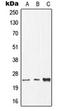 Deoxythymidylate Kinase antibody, orb213862, Biorbyt, Western Blot image 