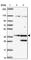 Small Glutamine Rich Tetratricopeptide Repeat Containing Alpha antibody, HPA056309, Atlas Antibodies, Western Blot image 