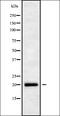 Ubiquitin Conjugating Enzyme E2 G1 antibody, orb336187, Biorbyt, Western Blot image 