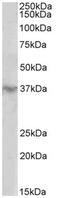 Homeobox D12 antibody, AP32154PU-N, Origene, Western Blot image 
