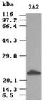 Sonic Hedgehog Signaling Molecule antibody, ADI-905-859-100, Enzo Life Sciences, Western Blot image 