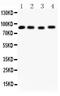 Heat Shock Protein 90 Alpha Family Class A Member 1 antibody, LS-C343954, Lifespan Biosciences, Western Blot image 