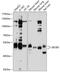 Eukaryotic Translation Initiation Factor 2B Subunit Gamma antibody, GTX64963, GeneTex, Western Blot image 