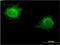 Zinc Finger Protein 239 antibody, H00008187-M27, Novus Biologicals, Immunofluorescence image 