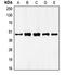 GATA Binding Protein 4 antibody, LS-C352237, Lifespan Biosciences, Western Blot image 