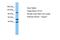 ATPase 13A3 antibody, A12070, Boster Biological Technology, Western Blot image 