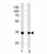 Tafazzin antibody, F51360-0.4ML, NSJ Bioreagents, Western Blot image 