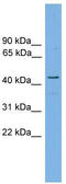 Retinol Dehydrogenase 16 antibody, TA346361, Origene, Western Blot image 