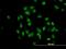 TUB Like Protein 2 antibody, H00007288-M03, Novus Biologicals, Immunocytochemistry image 