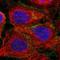 Catenin Delta 1 antibody, NBP1-85383, Novus Biologicals, Immunocytochemistry image 