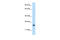 Achaete-Scute Family BHLH Transcription Factor 1 antibody, 27-561, ProSci, Western Blot image 