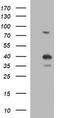 Uracil Phosphoribosyltransferase Homolog antibody, TA506874BM, Origene, Western Blot image 