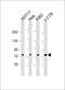 NDC80 Kinetochore Complex Component antibody, 61-289, ProSci, Western Blot image 