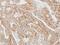 AP2M1 antibody, NBP1-32272, Novus Biologicals, Immunohistochemistry paraffin image 