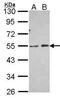 Phosphatidylinositol-5-Phosphate 4-Kinase Type 2 Alpha antibody, PA5-28435, Invitrogen Antibodies, Western Blot image 