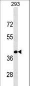 Kruppel Like Factor 15 antibody, LS-C160006, Lifespan Biosciences, Western Blot image 