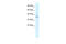 Kelch Like Family Member 14 antibody, 28-161, ProSci, Western Blot image 