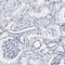 Major Histocompatibility Complex, Class II, DQ Alpha 1 antibody, PA5-52927, Invitrogen Antibodies, Immunohistochemistry frozen image 