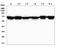 Neurofibromin 2 antibody, A00279-2, Boster Biological Technology, Western Blot image 