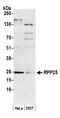 Ribonuclease P protein subunit p25 antibody, A305-093A, Bethyl Labs, Western Blot image 