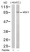 Ribosomal protein S6 kinase alpha-5 antibody, 79-578, ProSci, Western Blot image 