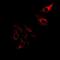 Pancreatic secretory trypsin inhibitor antibody, abx142241, Abbexa, Western Blot image 