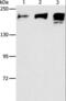 Angiotensin I Converting Enzyme antibody, LS-C406125, Lifespan Biosciences, Western Blot image 