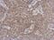 Tubulin Tyrosine Ligase Like 12 antibody, GTX120613, GeneTex, Immunohistochemistry paraffin image 