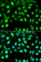 Gem Nuclear Organelle Associated Protein 2 antibody, A04530-1, Boster Biological Technology, Western Blot image 